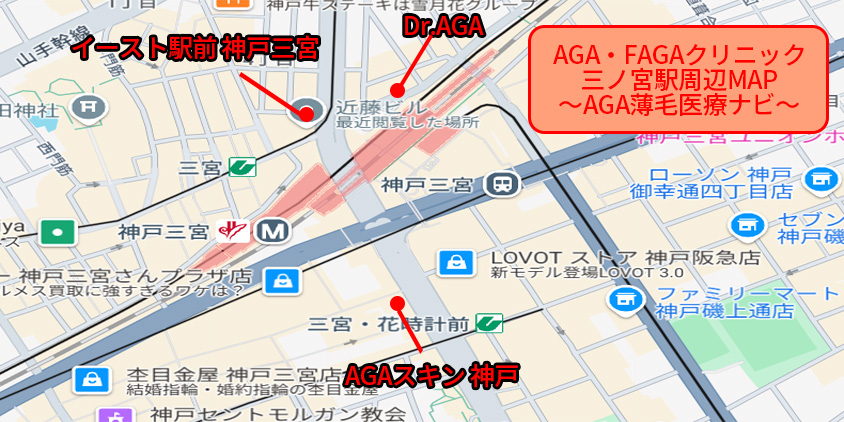 神戸 aga おすすめーAGA薄毛医療ナビ