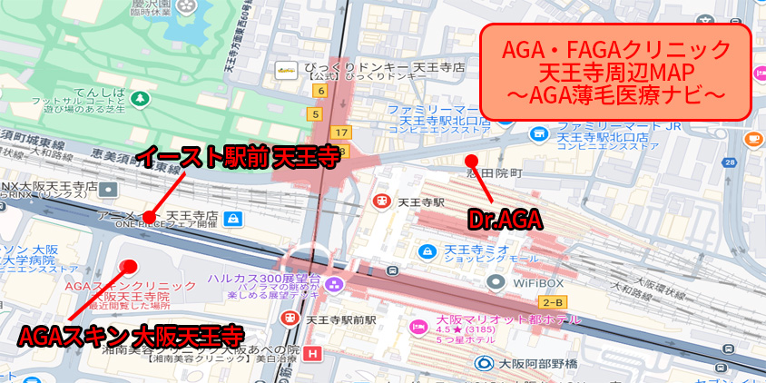 天王寺 AGA おすすめーAGA薄毛医療ナビ