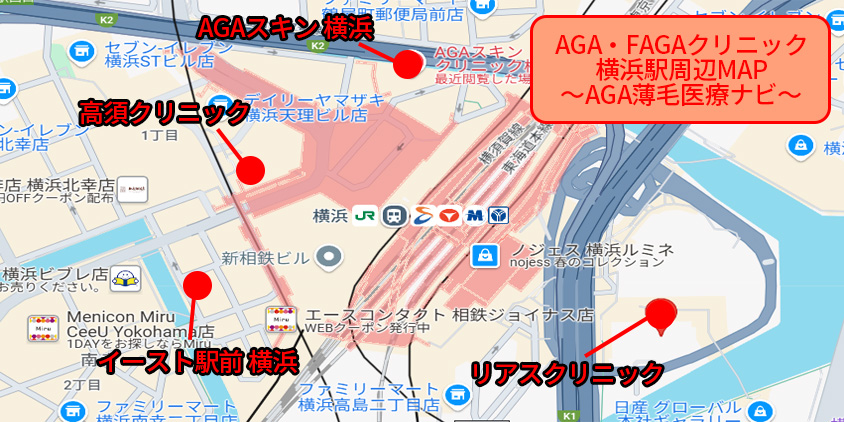 横浜 aga おすすめーAGA薄毛医療ナビ
