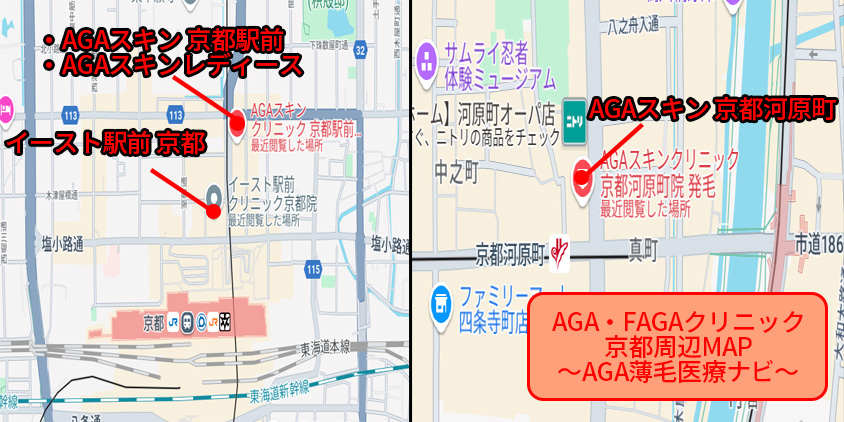 京都府 AGA クリニック