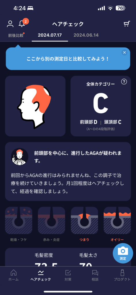 HIX ミノキシジル 評判ーAGA薄毛医療ナビ