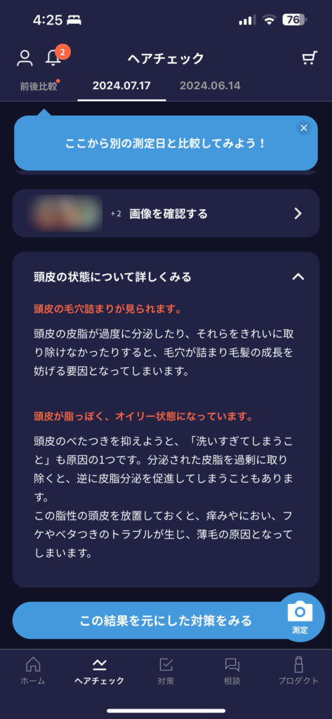 HIX ミノキシジル 評判ーAGA薄毛医療ナビ