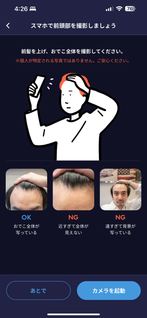 HIX ミノキシジル 評判ーAGA薄毛医療ナビ